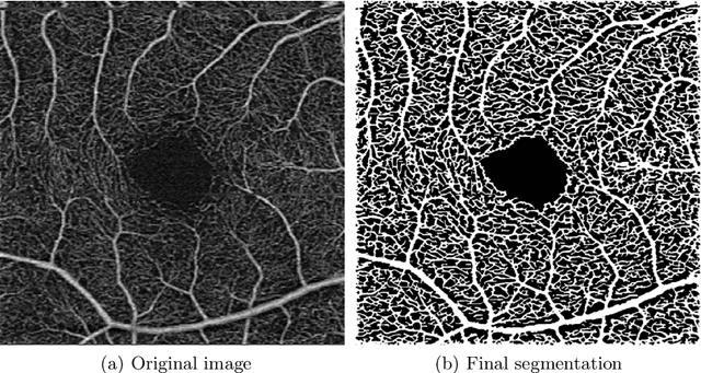 Figure 3 for Blood vessel segmentation in en-face OCTA images: a frequency based method