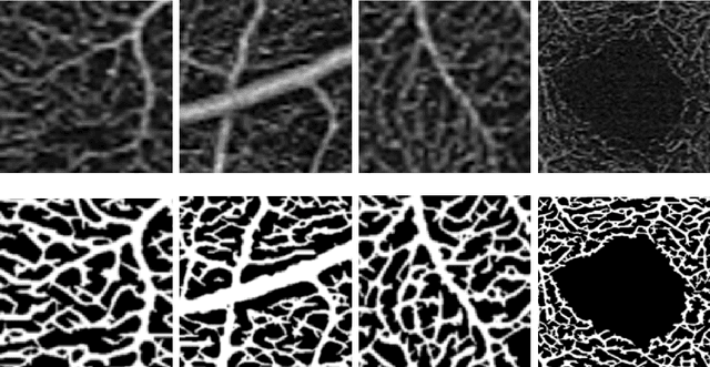 Figure 4 for Blood vessel segmentation in en-face OCTA images: a frequency based method