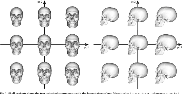 Figure 2 for A method for automatic forensic facial reconstruction based on dense statistics of soft tissue thickness