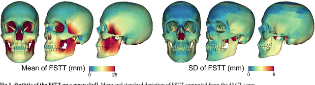 Figure 3 for A method for automatic forensic facial reconstruction based on dense statistics of soft tissue thickness