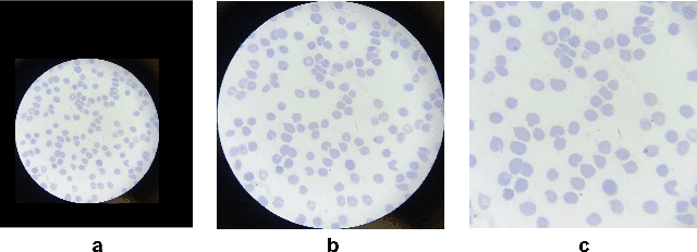 Figure 3 for A Dataset and Benchmark for Malaria Life-Cycle Classification in Thin Blood Smear Images