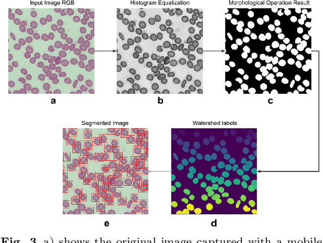 Figure 4 for A Dataset and Benchmark for Malaria Life-Cycle Classification in Thin Blood Smear Images