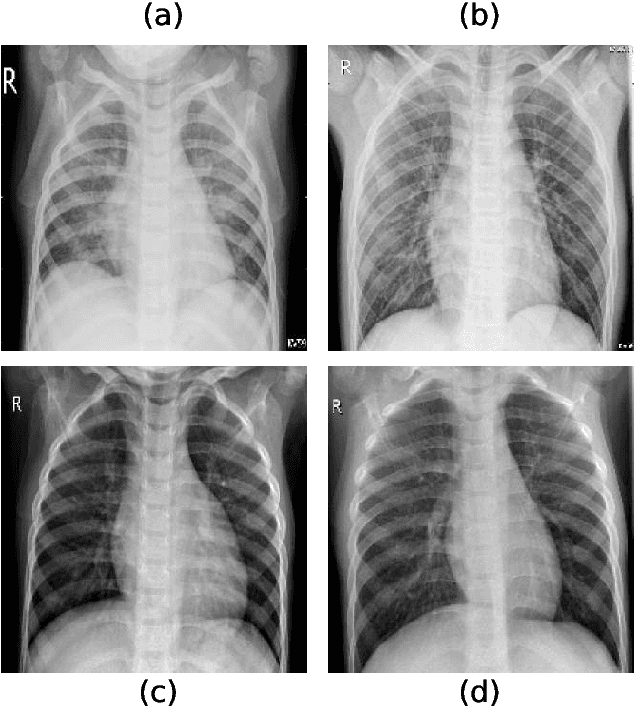 Figure 4 for Self-supervised deep convolutional neural network for chest X-ray classification