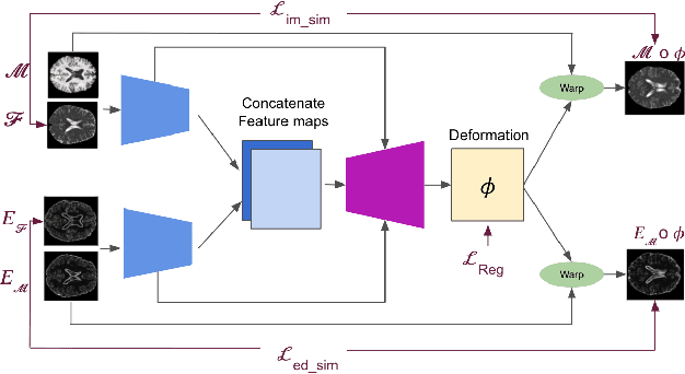 Figure 1 for Multi-modal unsupervised brain image registration using edge maps