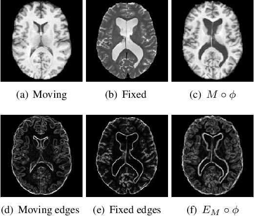 Figure 3 for Multi-modal unsupervised brain image registration using edge maps