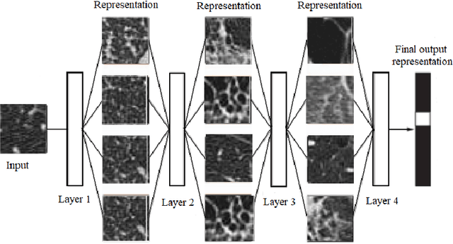 Figure 3 for An Efficient End-to-End Deep Neural Network for Interstitial Lung Disease Recognition and Classification