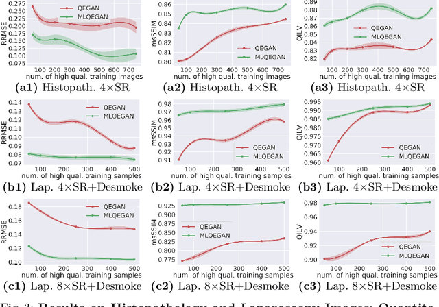 Figure 3 for A Mixed-Supervision Multilevel GAN Framework for Image Quality Enhancement