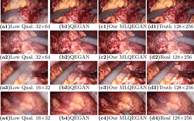 Figure 4 for A Mixed-Supervision Multilevel GAN Framework for Image Quality Enhancement