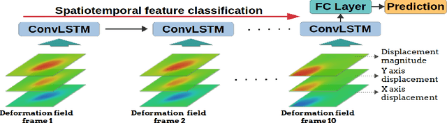 Figure 4 for FingerVision Tactile Sensor Design and Slip Detection Using Convolutional LSTM Network