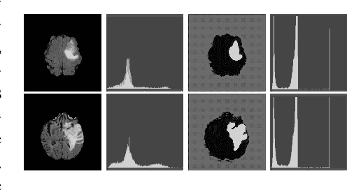Figure 3 for ASC-Net : Adversarial-based Selective Network for Unsupervised Anomaly Segmentation