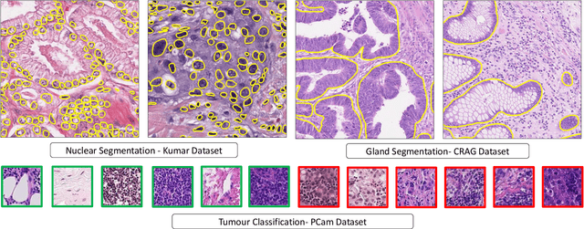 Figure 4 for Dense Steerable Filter CNNs for Exploiting Rotational Symmetry in Histology Images