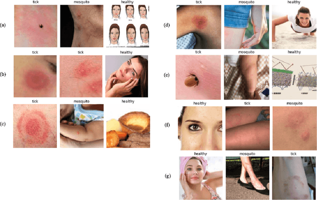 Figure 2 for Automatic Detection and Classification of Tick-borne Skin Lesions using Deep Learning