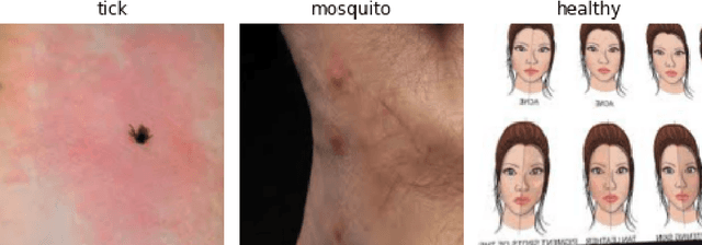 Figure 3 for Automatic Detection and Classification of Tick-borne Skin Lesions using Deep Learning