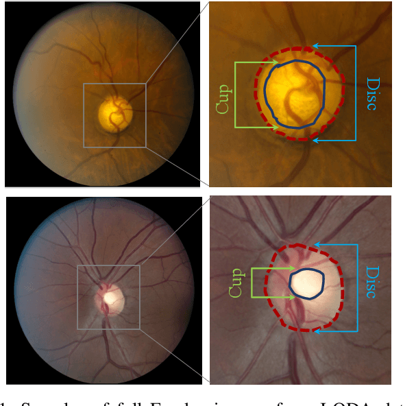 Figure 1 for Real-World Multi-Domain Data Applications for Generalizations to Clinical Settings