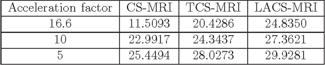 Figure 4 for Compressed sensing for longitudinal MRI: An adaptive-weighted approach