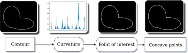 Figure 1 for Segmenting overlapped objects in images. A study to support the diagnosis of sickle cell disease