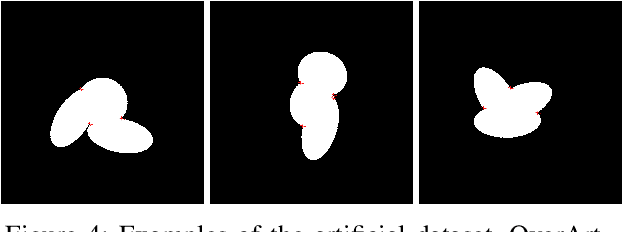 Figure 4 for Segmenting overlapped objects in images. A study to support the diagnosis of sickle cell disease