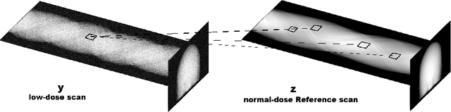 Figure 3 for Interpolation of CT Projections by Exploiting Their Self-Similarity and Smoothness