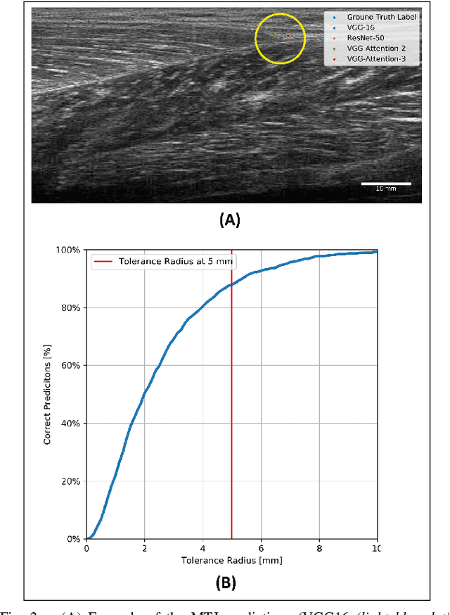 Figure 2 for Automatic Tracking of the Muscle Tendon Junction in Healthy and Impaired Subjects using Deep Learning