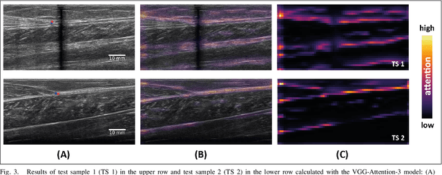 Figure 3 for Automatic Tracking of the Muscle Tendon Junction in Healthy and Impaired Subjects using Deep Learning
