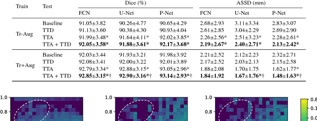 Figure 2 for Aleatoric uncertainty estimation with test-time augmentation for medical image segmentation with convolutional neural networks