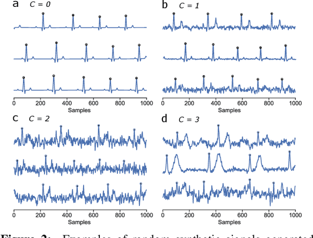 Figure 2 for Training neural networks with synthetic electrocardiograms