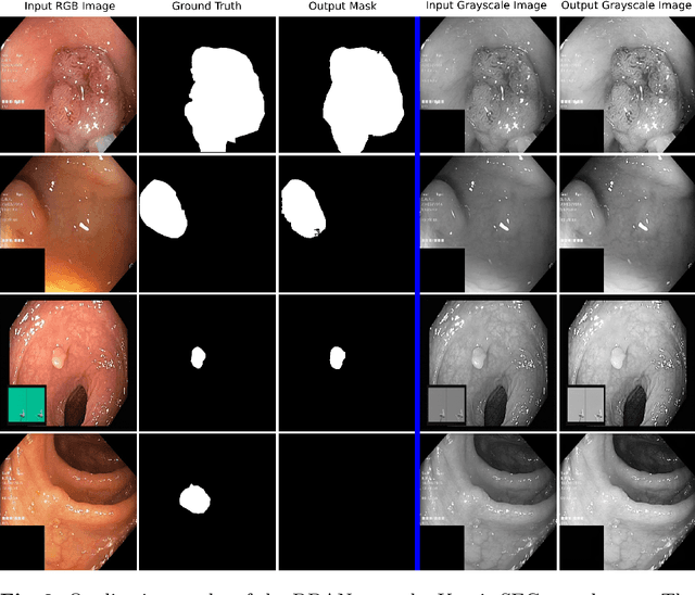 Figure 2 for DDANet: Dual Decoder Attention Network for Automatic Polyp Segmentation