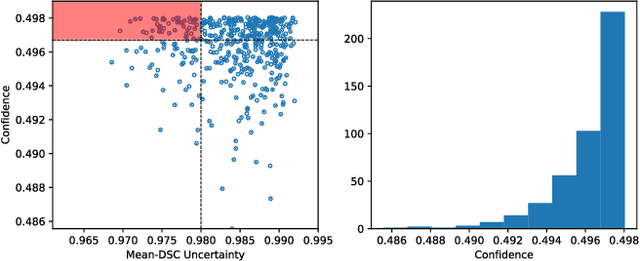 Figure 3 for DSAL: Deeply Supervised Active Learning from Strong and Weak Labelers for Biomedical Image Segmentation