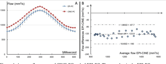 Figure 4 for Accuracy of Real-Time Echo-Planar Imaging Phase Contrast MRI