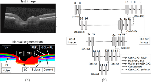 Figure 2 for Describing the Structural Phenotype of the Glaucomatous Optic Nerve Head Using Artificial Intelligence