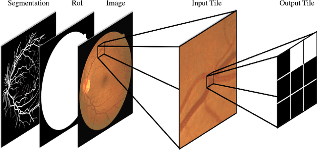 Figure 1 for Region Growing with Convolutional Neural Networks for Biomedical Image Segmentation