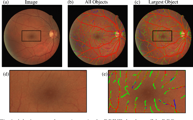 Figure 3 for Region Growing with Convolutional Neural Networks for Biomedical Image Segmentation