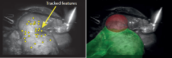 Figure 3 for Deep Feature Tracker: A Novel Application for Deep Convolutional Neural Networks