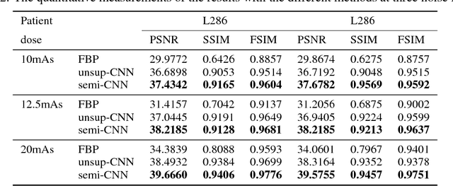 Figure 4 for Unsupervised/Semi-supervised Deep Learning for Low-dose CT Enhancement