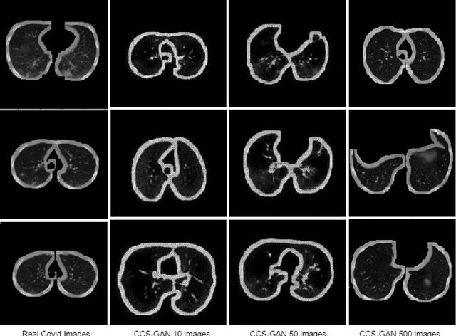 Figure 4 for CCS-GAN: COVID-19 CT-scan classification with very few positive training images