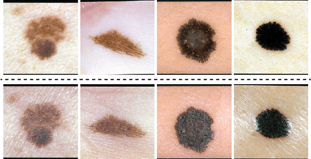 Figure 3 for Skin Deep Unlearning: Artefact and Instrument Debiasing in the Context of Melanoma Classification