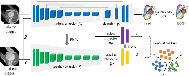 Figure 1 for Self-Ensembling Contrastive Learning for Semi-Supervised Medical Image Segmentation