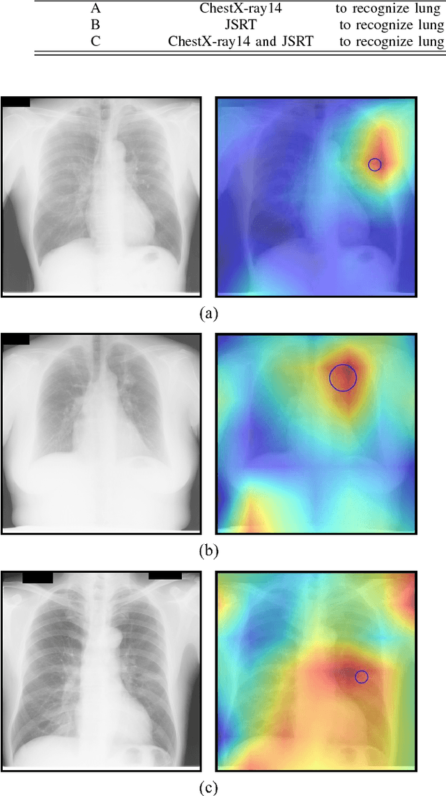 Figure 3 for Automatic Lung Cancer Prediction from Chest X-ray Images Using Deep Learning Approach