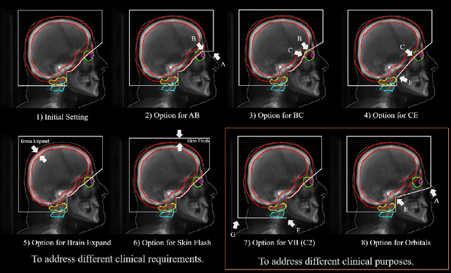 Figure 3 for Automated WBRT Treatment Planning via Deep Learning Auto-Contouring and Customizable Landmark-Based Field Aperture Design
