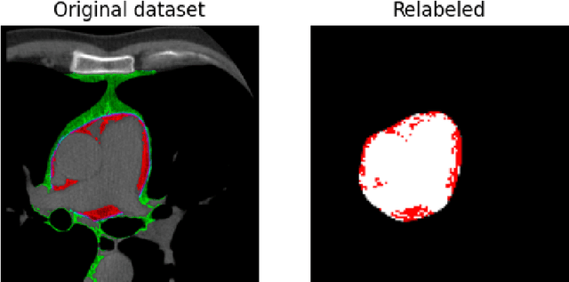 Figure 1 for Epicardial Adipose Tissue Segmentation from CT Images with A Semi-3D Neural Network