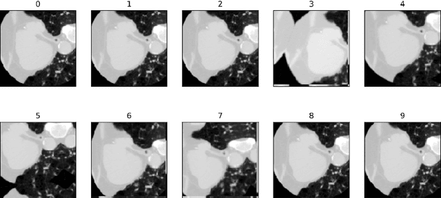 Figure 3 for Epicardial Adipose Tissue Segmentation from CT Images with A Semi-3D Neural Network