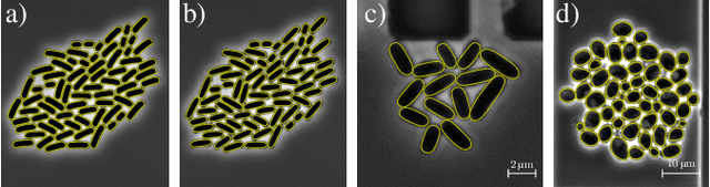 Figure 4 for A hybrid multi-object segmentation framework with model-based B-splines for microbial single cell analysis