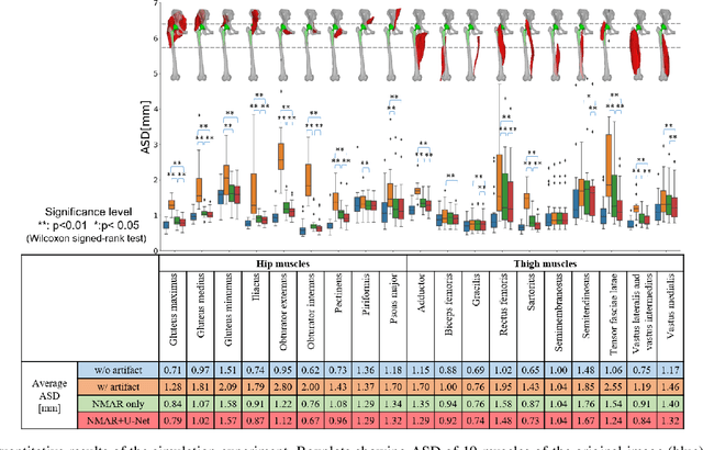 Figure 3 for Automated Segmentation of Hip and Thigh Muscles in Metal Artifact-Contaminated CT using Convolutional Neural Network-Enhanced Normalized Metal Artifact Reduction