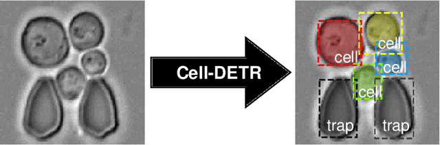 Figure 1 for Attention-Based Transformers for Instance Segmentation of Cells in Microstructures