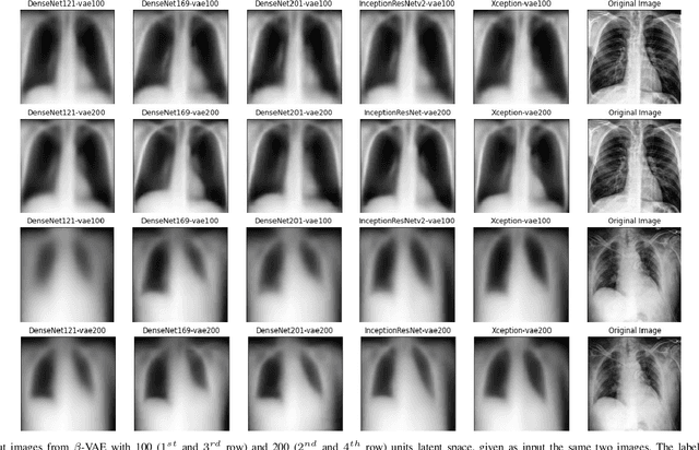 Figure 2 for Chest X-Rays Image Classification from beta-Variational Autoencoders Latent Features