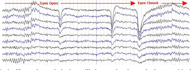 Figure 3 for Computational EEG in Personalized Medicine: A study in Parkinson's Disease