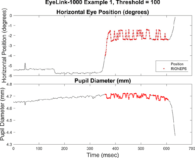 Figure 1 for Method to Detect Eye Position Noise from Video-Oculography when Detection of Pupil or Corneal Reflection Position Fails