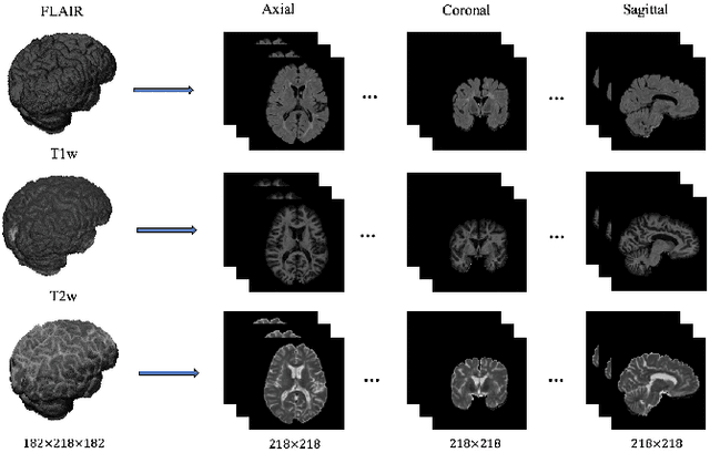 Figure 1 for Multi-branch Convolutional Neural Network for Multiple Sclerosis Lesion Segmentation
