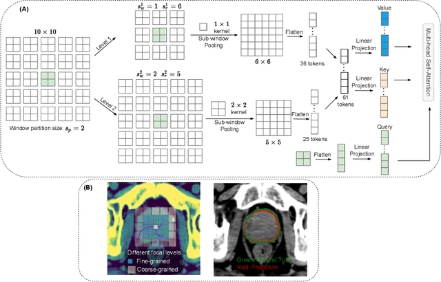 Figure 1 for FocalUNETR: A Focal Transformer for Boundary-aware Segmentation of CT Images