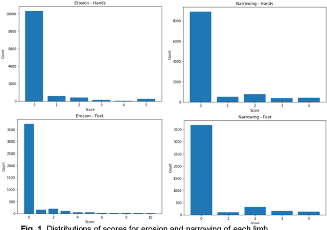 Figure 1 for Rheumatoid Arthritis: Automated Scoring of Radiographic Joint Damage